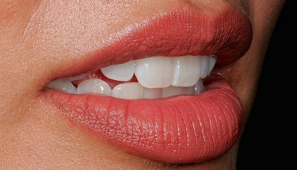 sorriso580